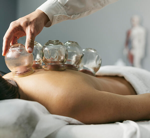 Benifits of Cupping Therapy